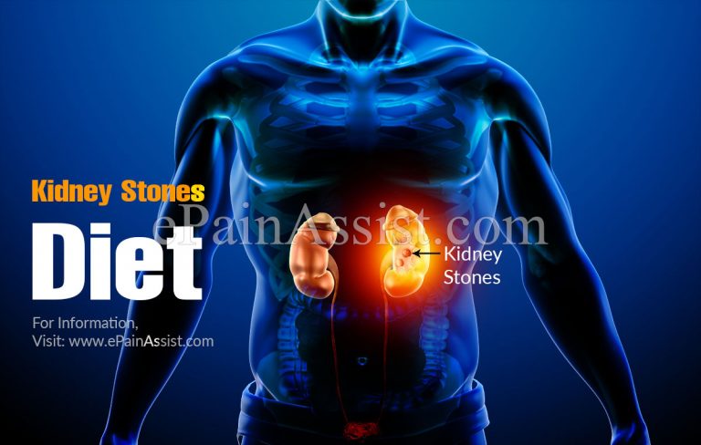 Kidney Stones Diet: Foods To Eat & Foods To Avoid If You Have Kidney Stones