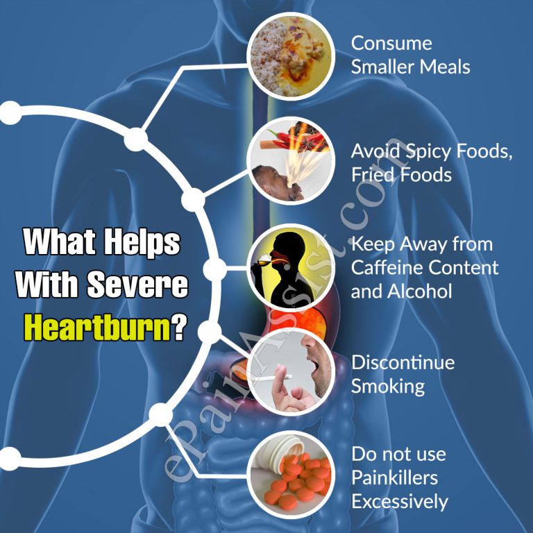 What Helps With Severe Heartburn?