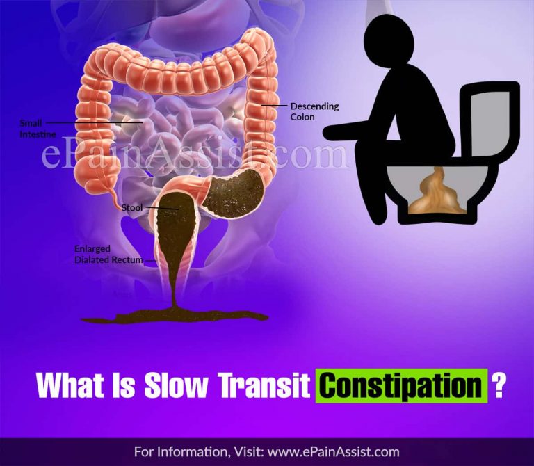 Slow Transit Constipation: Symptoms, Diagnosis, Treatments