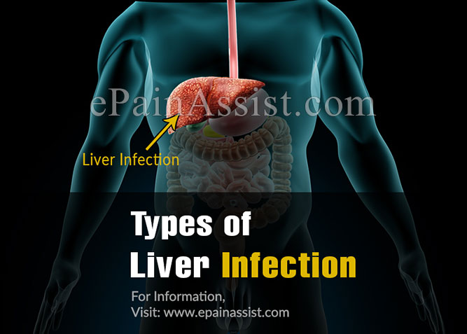 Types of Liver Infections