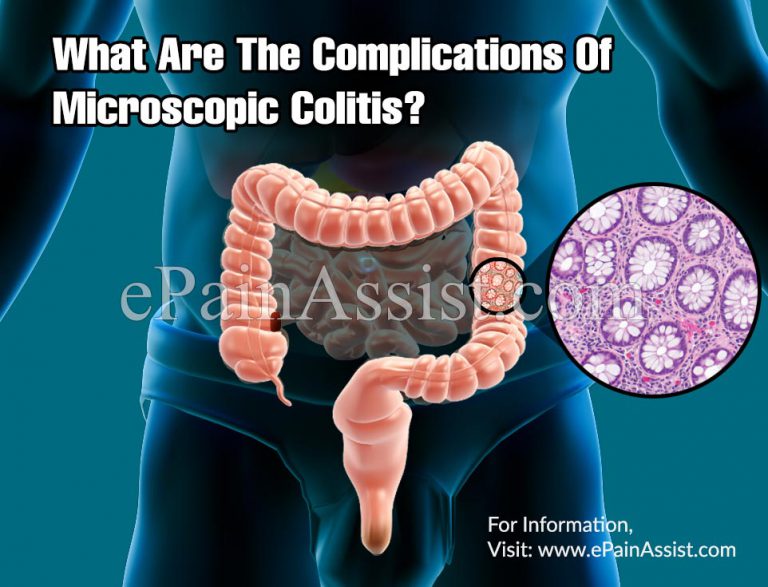 What Are The Complications Of Microscopic Colitis?
