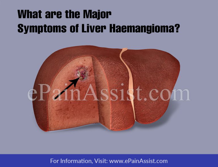 What Are The Major Symptoms Of Liver Hemangioma?