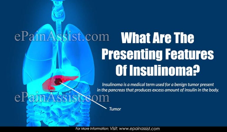 What Are The Presenting Features Of Insulinoma?