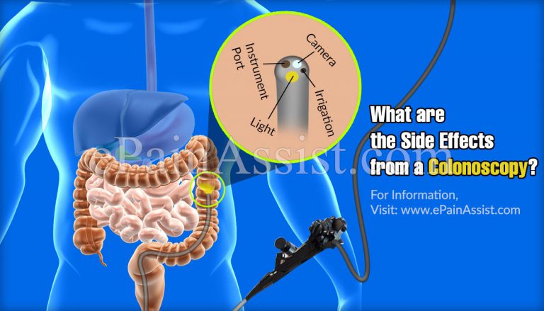What are the Side Effects from a Colonoscopy?