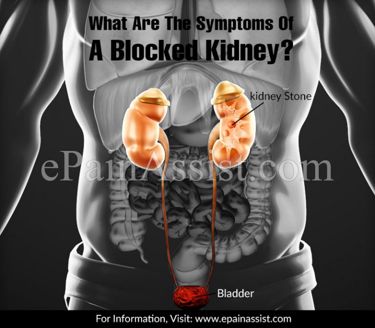 What Are The Symptoms Of A Blocked Kidney?