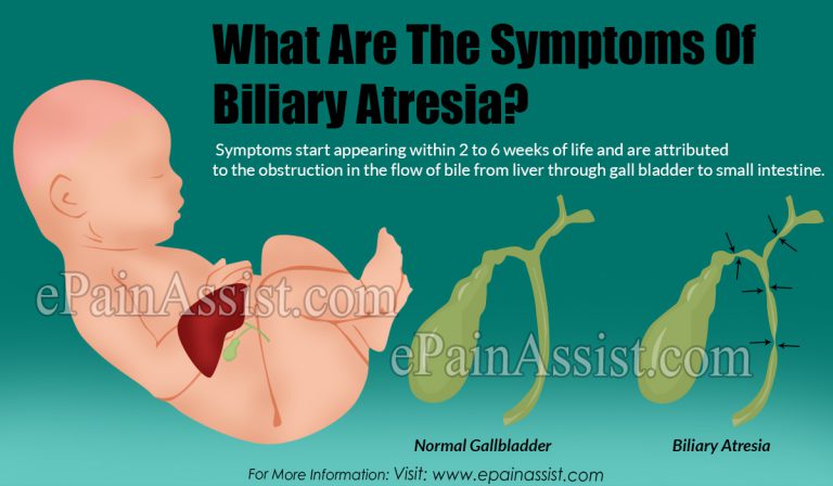 What Are The Symptoms Of Biliary Atresia?
