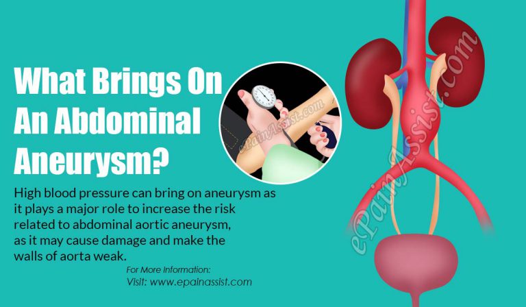 What Brings On An Abdominal Aneurysm?