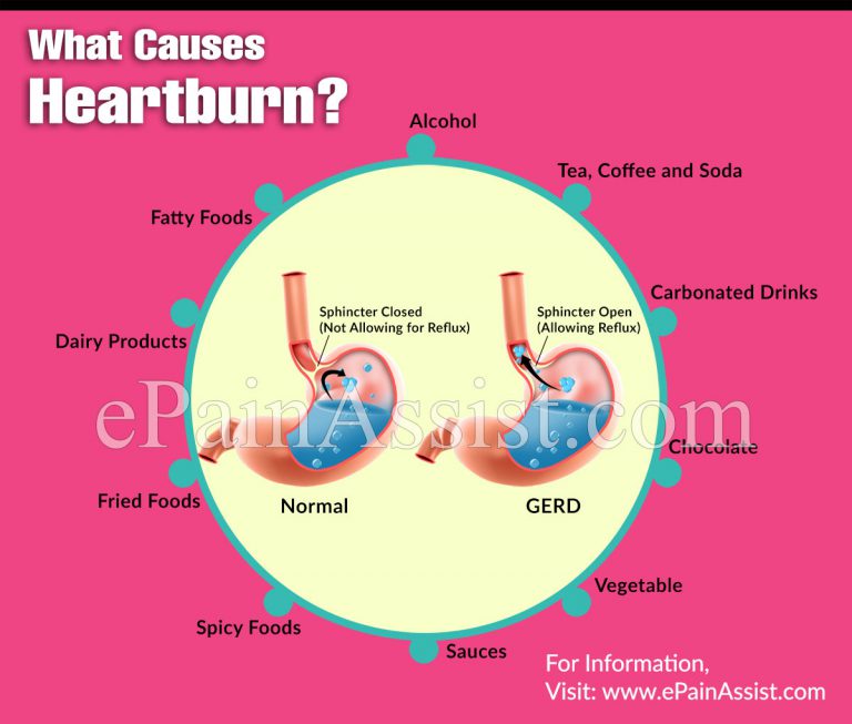What Causes Heartburn & What are its Risk Factors?