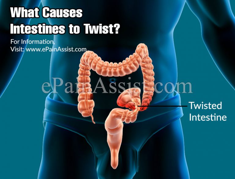 What Causes Intestines to Twist & Can a Twisted Intestine Get Untwist By Itself?