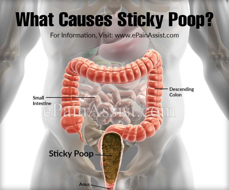 What Causes Sticky Poop & What To Do About It?