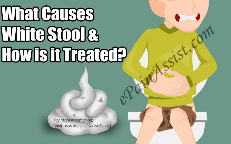 What Causes White Stool & How is it Treated?|Symptoms, Diagnosis, Prevention of White Stools