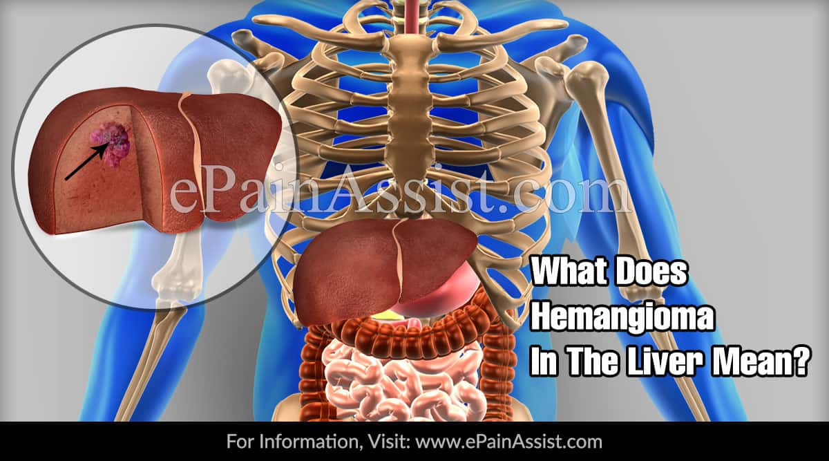 What Does Hemangioma In The Liver Mean?