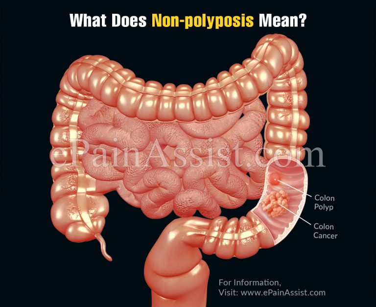 What Does Non-polyposis Mean?