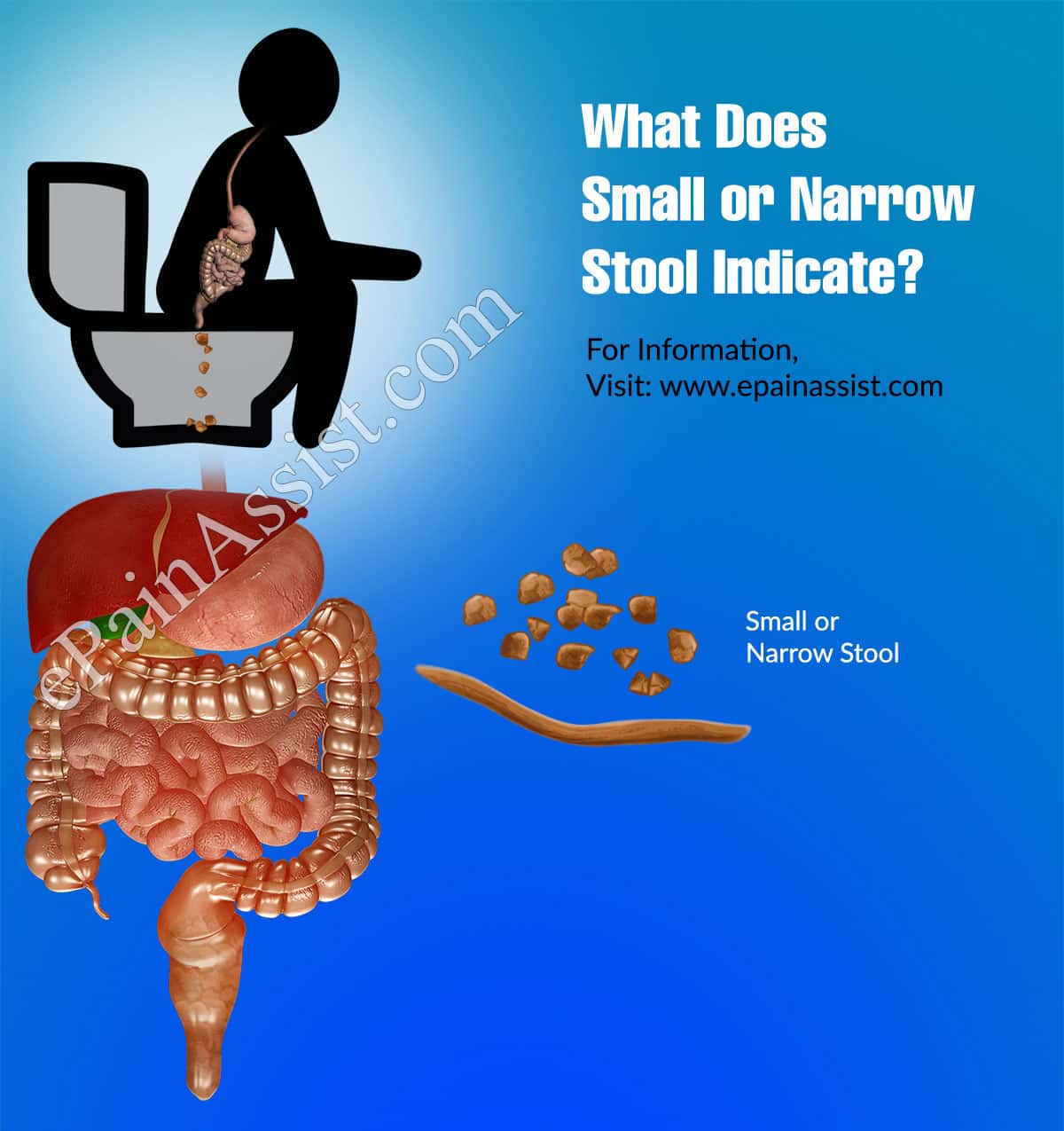 What Does Small Or Narrow Stool Indicate