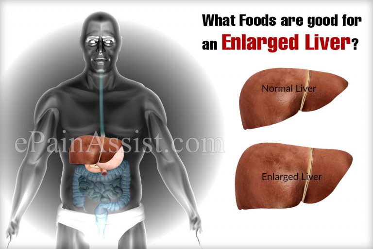 What Foods Are Good For An Enlarged Liver?