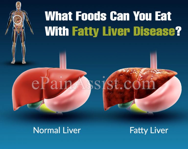 What Foods Can You Eat With Fatty Liver Disease?