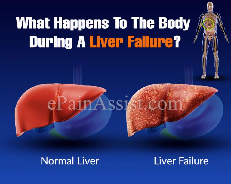 What Happens To The Body During A Liver Failure?