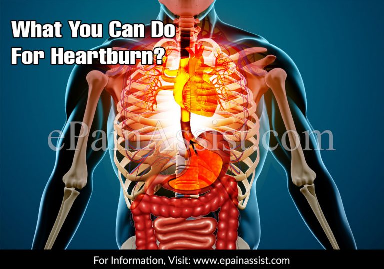 What Helps with Heartburn?