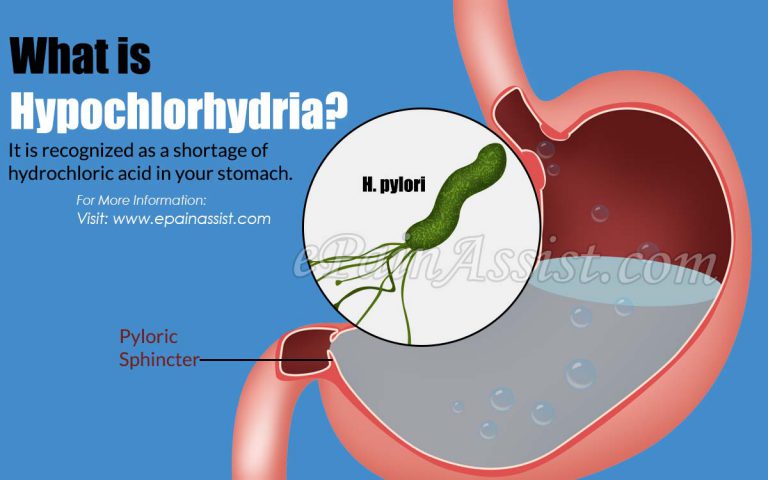 Hypochlorhydria: Causes, Symptoms, Treatment, Diagnosis
