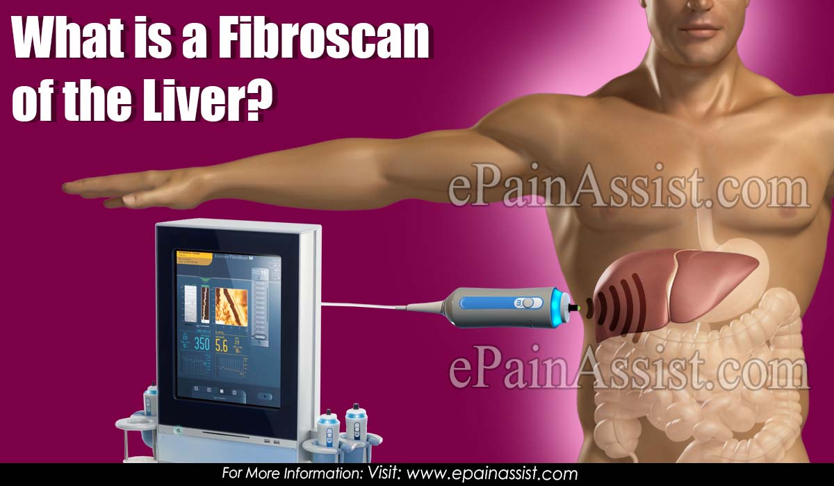 What is a Fibroscan of the Liver?