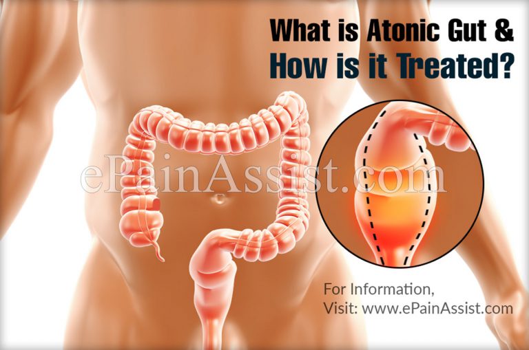 What is Atonic Gut & How is it Treated, Prevented?