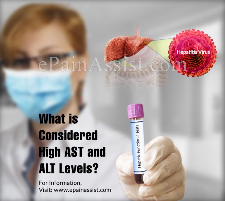 What is Considered High AST and ALT Levels?
