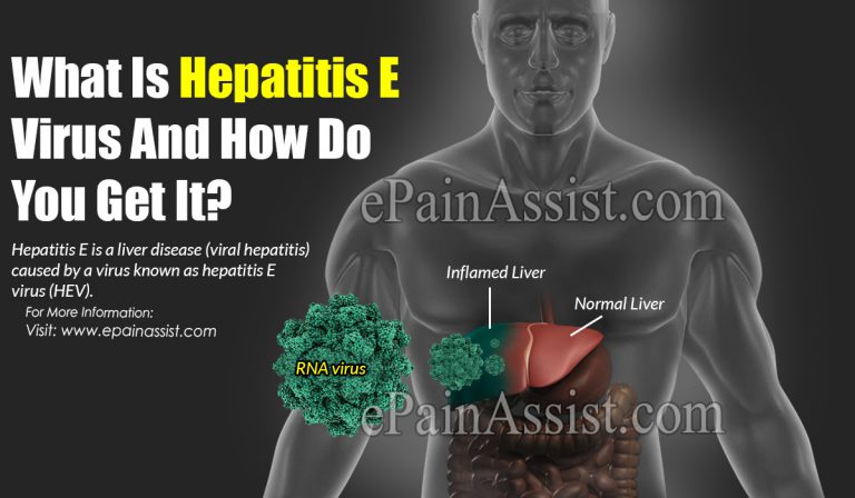 What Is Hepatitis E Virus And How Do You Get It?