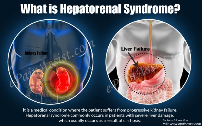 What is Hepatorenal Syndrome & How is it Treated?|Types, Causes, Symptoms, Life Expectancy, Prognosis of Hepatorenal Syndrome