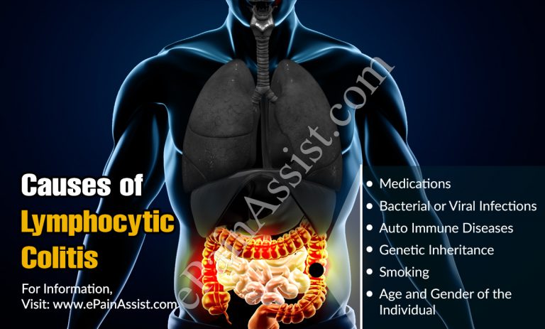 What is Lymphocytic Colitis: Symptoms, Causes, Treatment, Prognosis, Risk Factors
