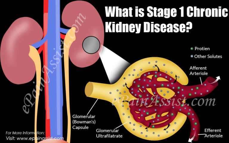 What is Stage 1 Chronic Kidney Disease?