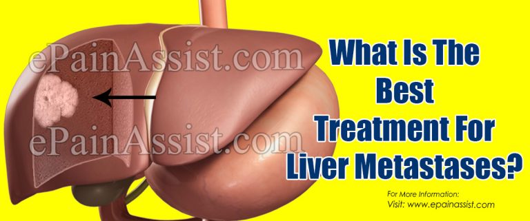 What Is The Best Treatment For Liver Metastases?