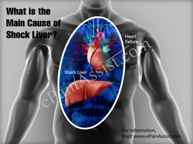 What is The Main Cause of Shock Liver?