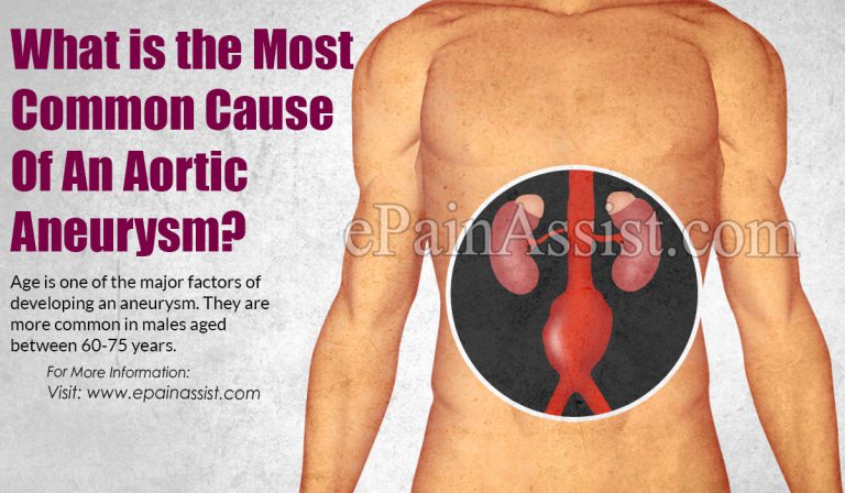 What is the Most Common Cause Of An Aortic Aneurysm?