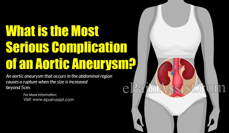 Which is the Most Serious Complication Of An Aortic Aneurysm?