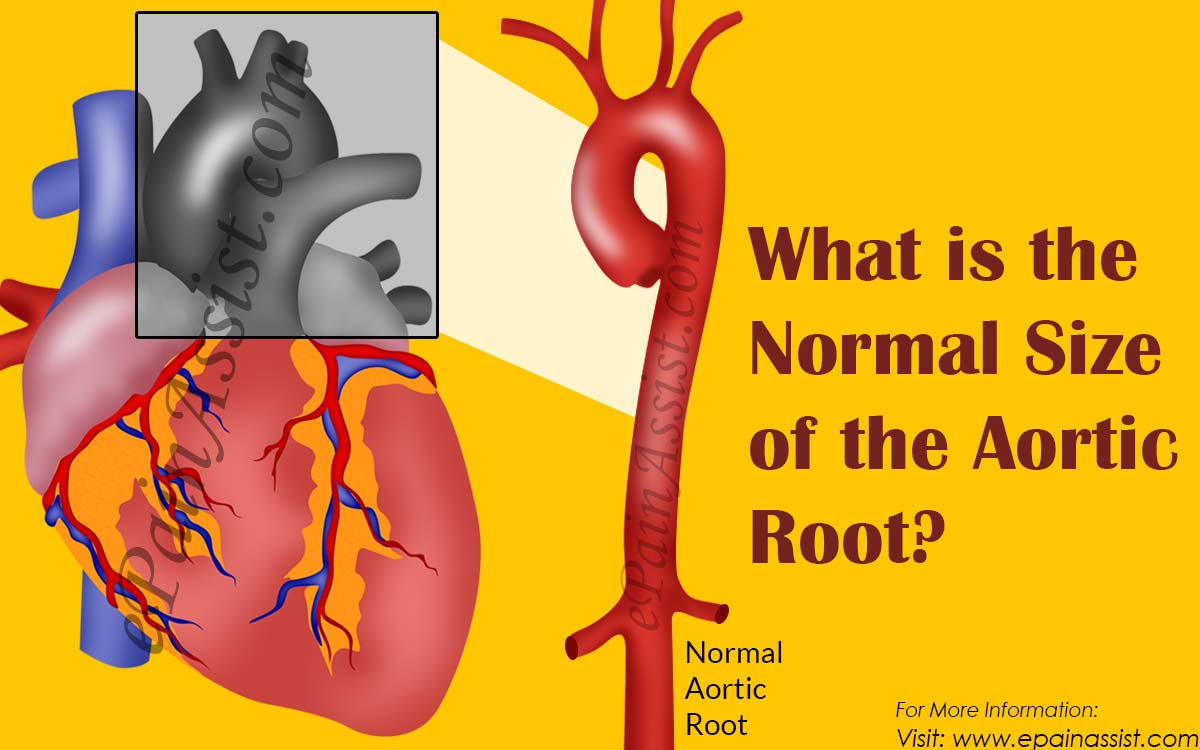 Aortic Root Size Chart