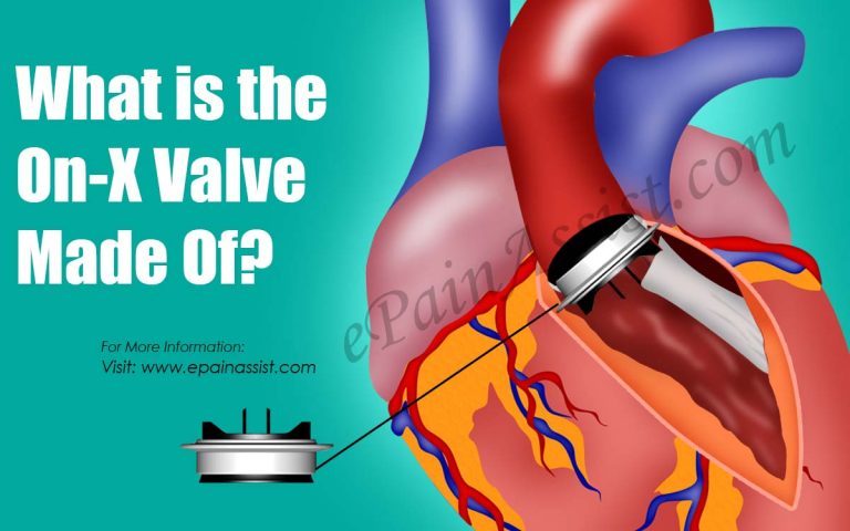 What is the On-X Valve Made Of?