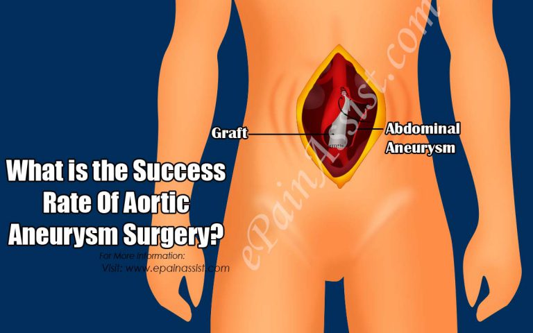 What is the Success Rate Of Aortic Aneurysm Surgery?