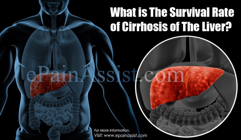 What is The Survival Rate of Cirrhosis of The Liver?