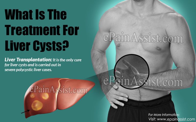 What Is The Treatment For Liver Cysts?