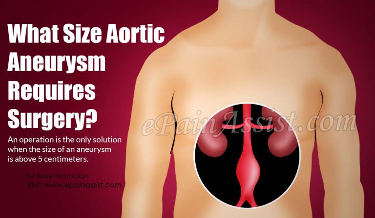 What Size Aortic Aneurysm Requires Surgery?