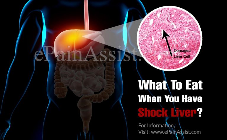 What To Eat When You Have Shock Liver?