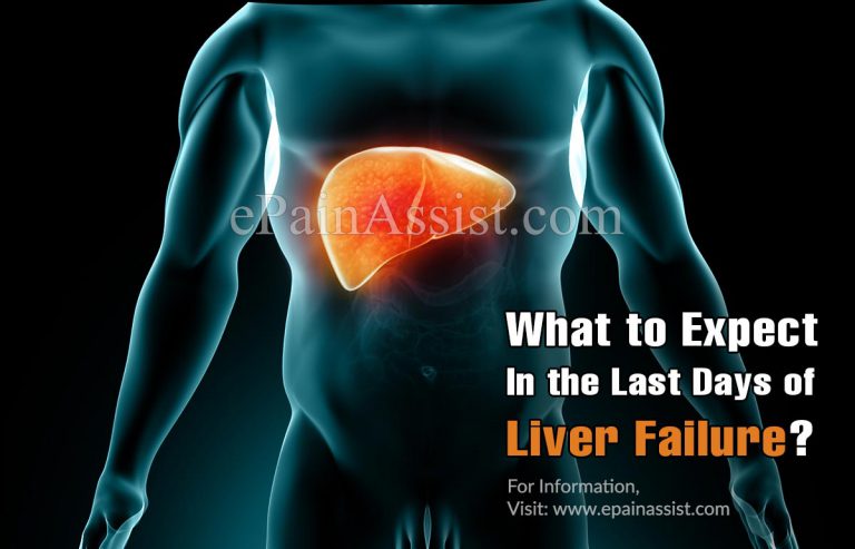 What to Expect In the Last Days of Liver Failure?