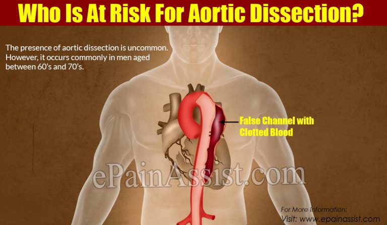 Who Is At Risk For Aortic Dissection?