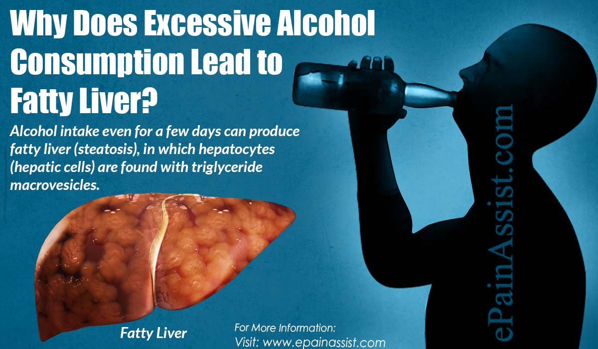 Why Does Excessive Alcohol Consumption Lead to Fatty Liver?