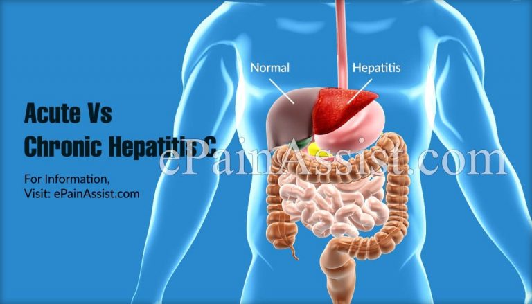 Acute Vs Chronic Hepatitis C & Your Treatment Options