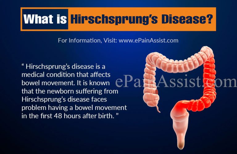 Association of Hirschsprung’s Disease and Anorectal Malformation