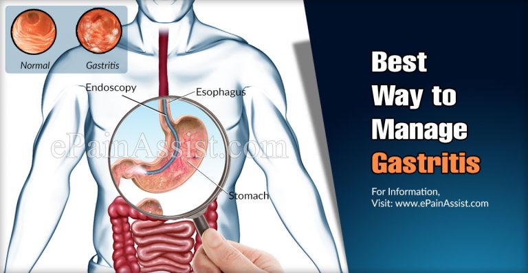 Best Way to Manage Gastritis