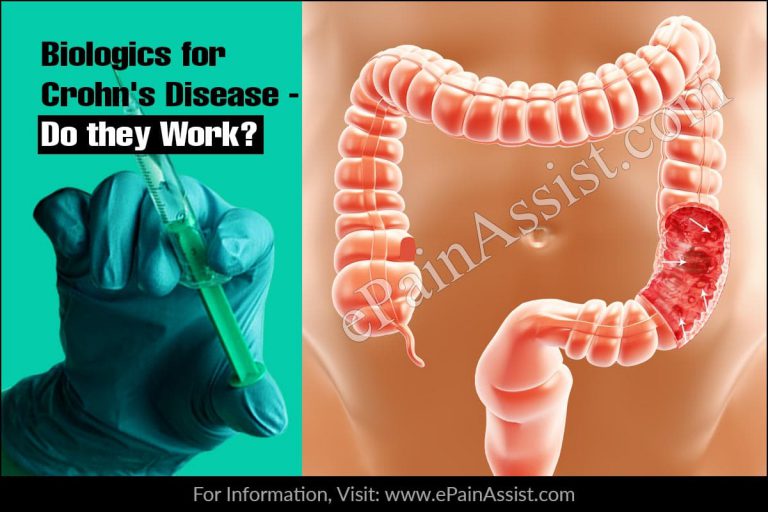 Biologics for Crohn’s Disease – Do they Work?