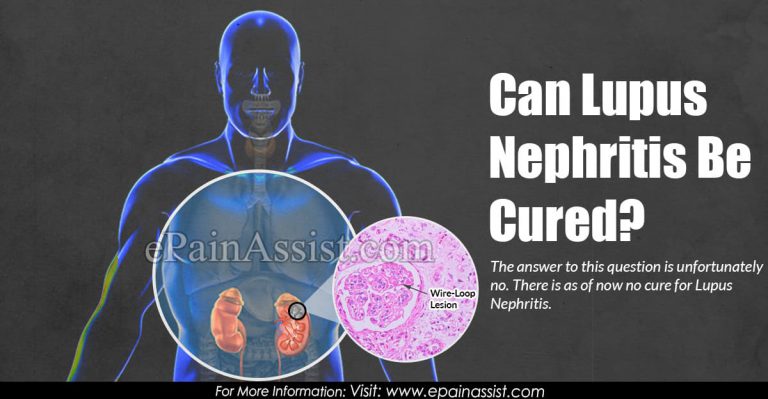Can Lupus Nephritis Be Cured?