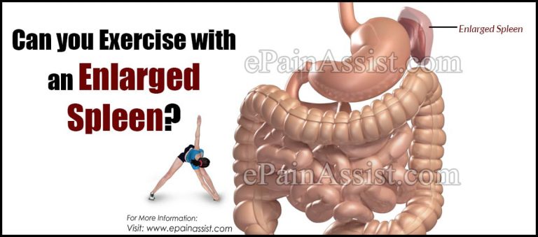 Can you Exercise with an Enlarged Spleen and Which are the Safe Exercises for Enlarged Spleen?